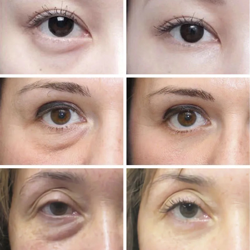 Przeciwzmarszczkowy Anti Dark  – Retinol Anti Wrinkle Cream recenzja i cena
