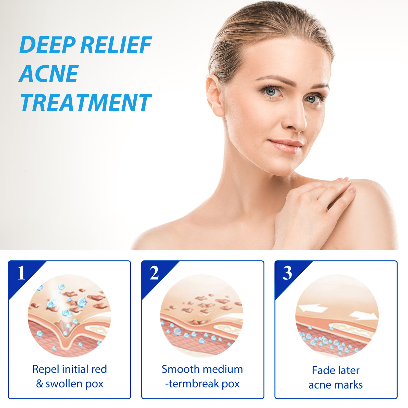 EELHOE balsam do leczenia trąd – Salicylic Acid Blackhead Remover recenzja i cena