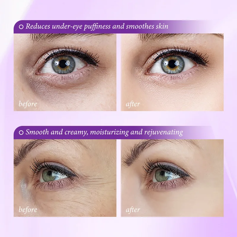 Krem do natychmiastowego usuwa – Retinol Anti Wrinkle Cream recenzja i cena