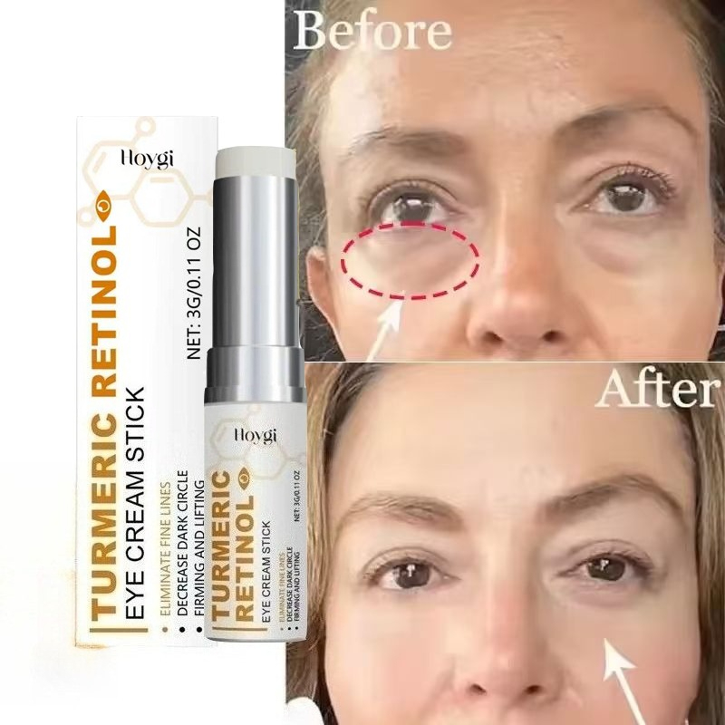 Krem do natychmiastowego usuwa – Retinol Anti Wrinkle Cream recenzja i cena